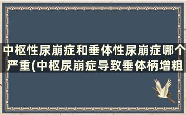 中枢性尿崩症和垂体性尿崩症哪个严重(中枢尿崩症导致垂体柄增粗)