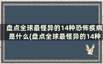 盘点全球最怪异的14种恐怖疾病是什么(盘点全球最怪异的14种恐怖疾病)