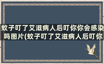 蚊子叮了艾滋病人后叮你你会感染吗图片(蚊子叮了艾滋病人后叮你你会感染吗图片)