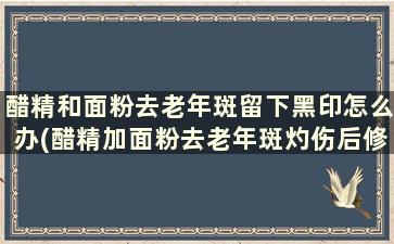 醋精和面粉去老年斑留下黑印怎么办(醋精加面粉去老年斑灼伤后修复)